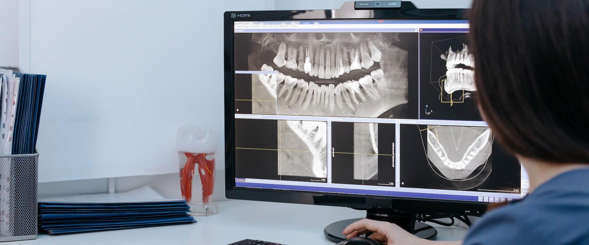 At Smile Studio Delhi, we offer Panoramic X-rays, Intra-Oral X-rays (RVG), and Bite Wing X-rays.