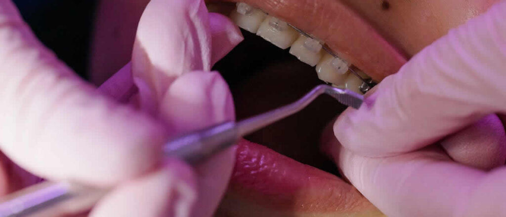 Smile Makeover in South Delhi How Modern Dentistry Can Transform Your Smile