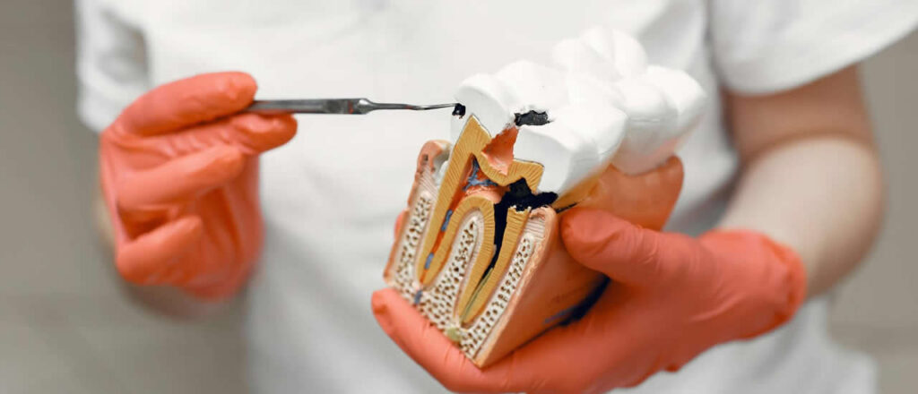 Root Canal Treatment in Greater Kailash-1 Everything Patients Should Know