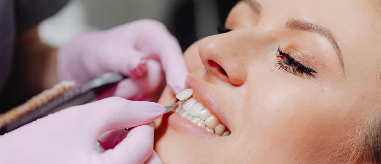 Teeth Whitening in Greater Kailash Safe Ways to Brighten Your Smile